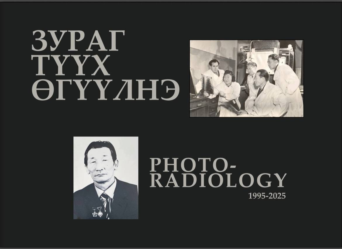 Монголын радиологийн хөгжил дэвшлийн замналын 30 жил - Зургийн цомог